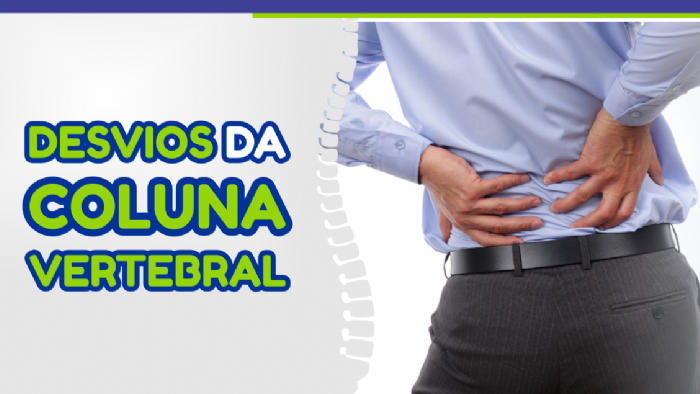 Imagem de DESVIOS DA COLUNA VERTEBRAL 
